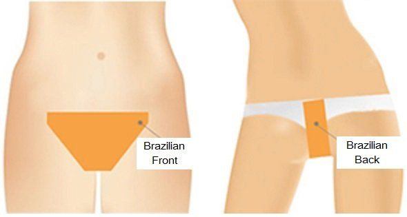 best of Treatment bikini line photos hair Laser