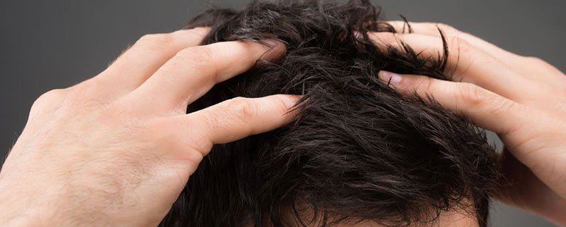 best of And hair Facial loss scalp