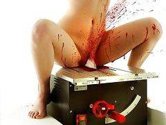 best of Anal bloody beat girl